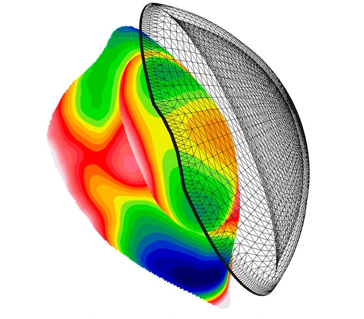 Scleral lens fitting process in Cambridge